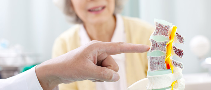 a doctor pointing to a spinal disc statue